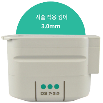 3.0mm