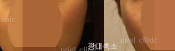 [라인업] 우리엘 광대축소