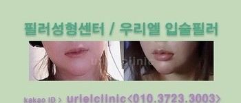 [입술] 입술필러