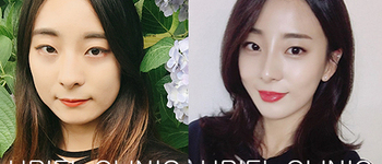 [풀페이스] 풀페이스 필러, 라인업 주사