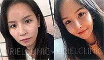[풀페이스] 풀페이스 필러